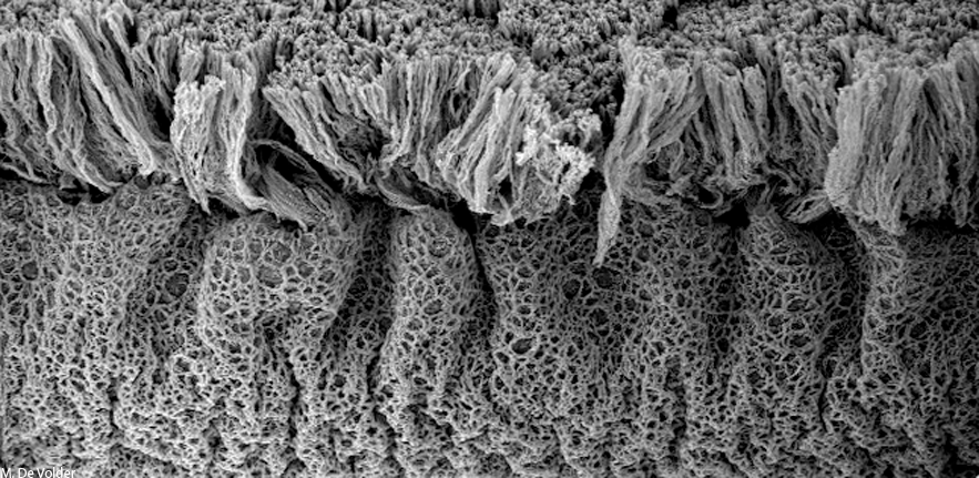 Forest of Amorphous Carbon Nanowires